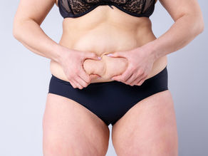 Tummy Tuck Abdominoplasty Surgery in ANTALYA TURKEY